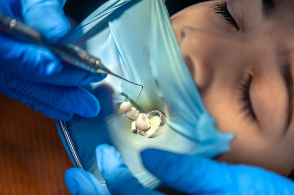 The dentist treats the child's tooth using a rubber dam. Installing a filling in a tooth.